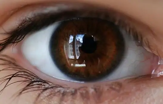 Bu belirtiler sizde de varsa muhtemelen göz kanseri olabilirsiniz!